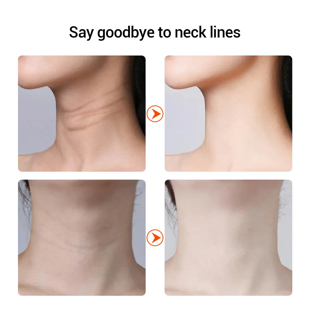Neck Face Massage EMS Double Chin Remover V Line Chin Lift Up 3 Colors LED Devices Anti Neck Wrinkle Face Slimmer Chin Reducer