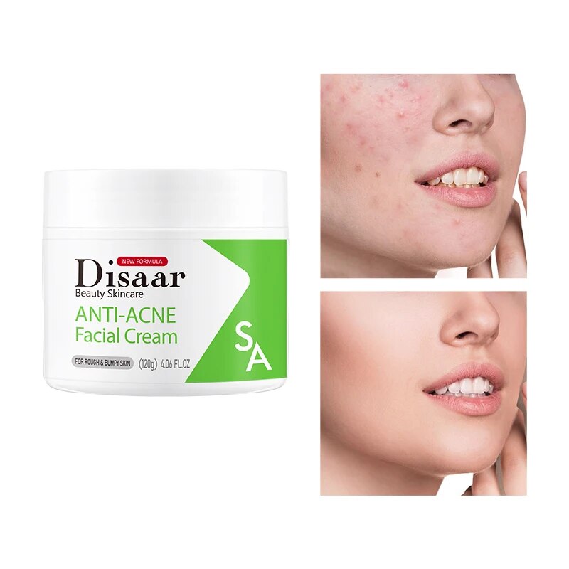 Disaar Anti-Acne Skin Care Set Face Serum Cream Gel Salicylic Acid Facial Wash Soap Body Loiton Repair Calming Soothing