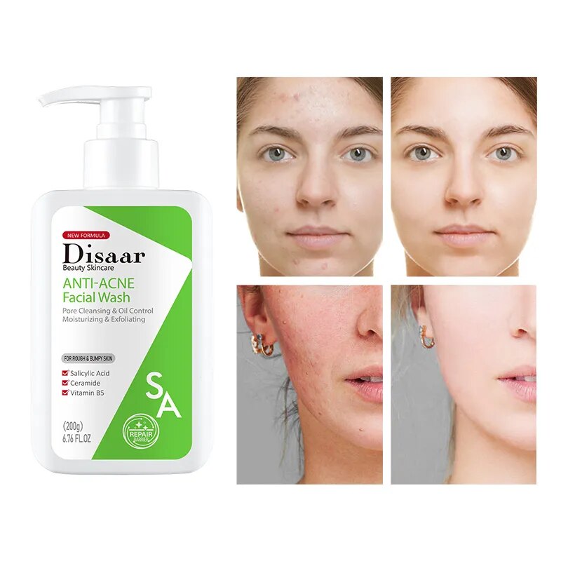 Disaar Anti-Acne Skin Care Set Face Serum Cream Gel Salicylic Acid Facial Wash Soap Body Loiton Repair Calming Soothing