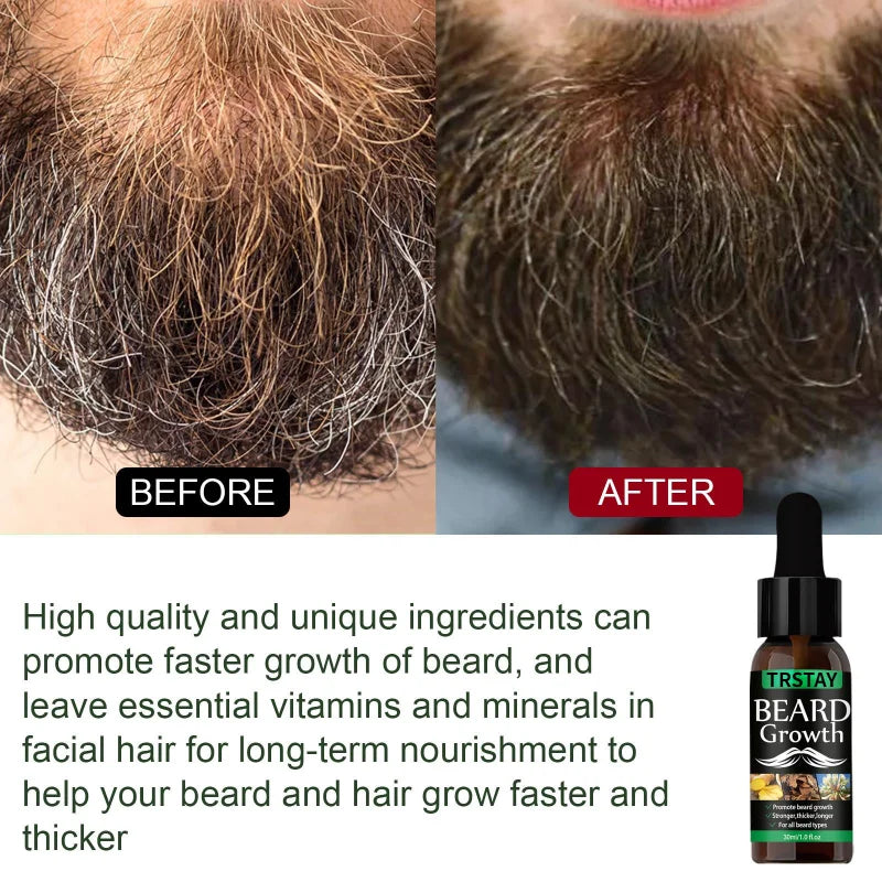 NEW Beard Hair Growth Essential Oil Anti Hair Loss Product Natural Mustache Regrowth Oil for Men Nourishing Beard Care Roller